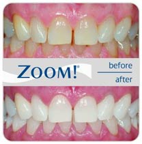 zoom2 teeth whitening before after